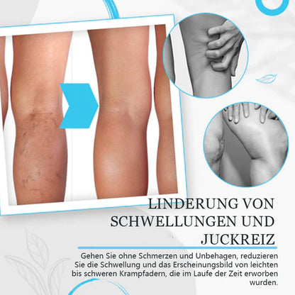 Seurico™ Krampfadern Behandlung Creme